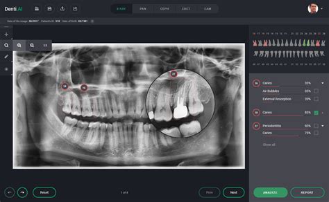 Denti Ai